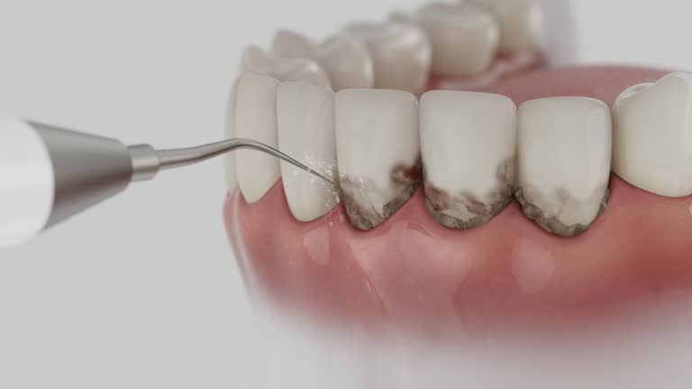 Trusted Teeth Cleaning And Checkup service in Timberville, VA - Dentist Open Now